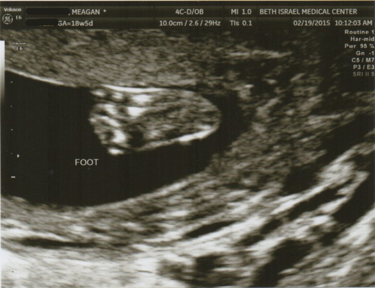 BabyMJ_18weeks-FOOTedit