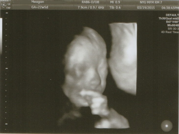 3D image from our 4D scan on Thursday.